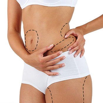 Liposuction